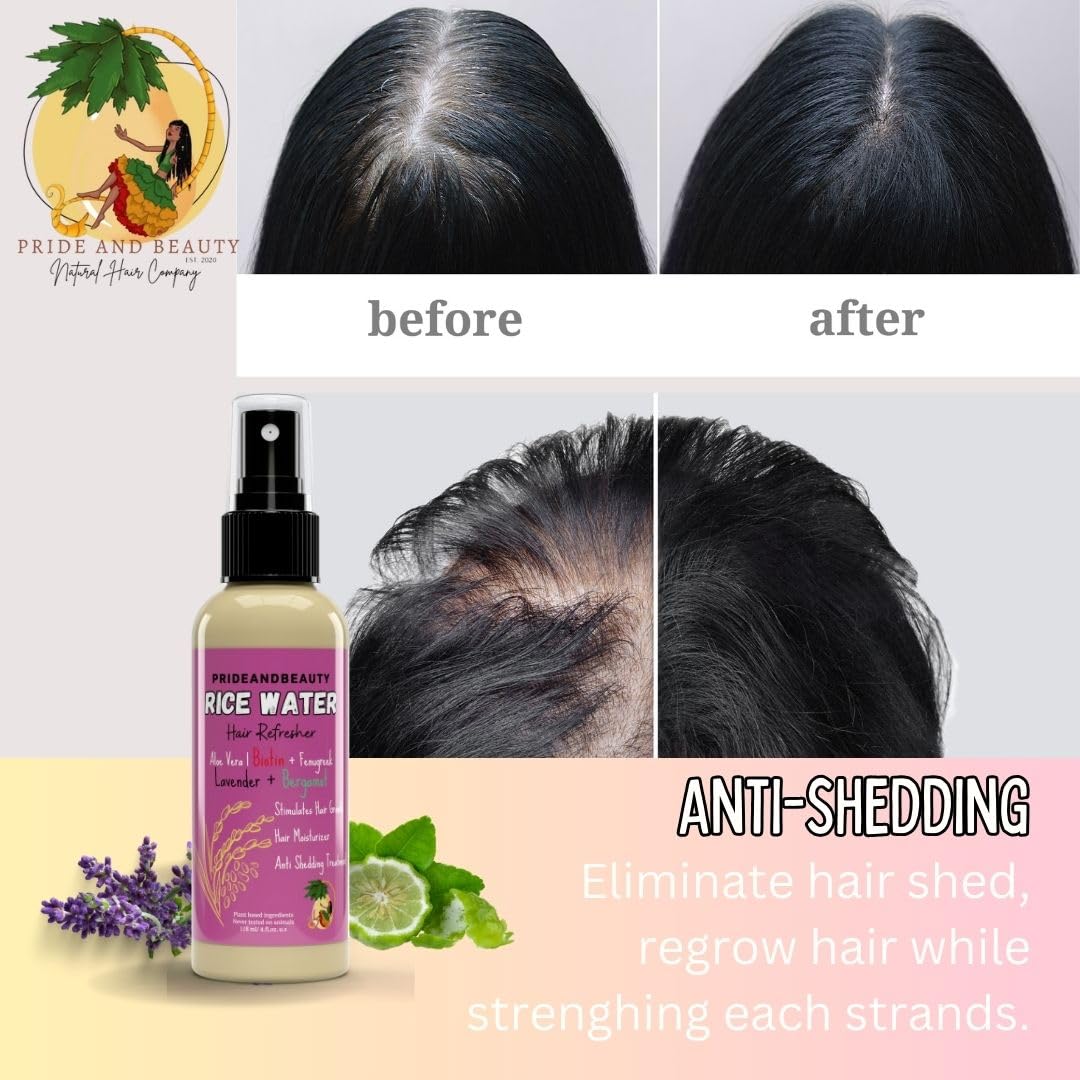 Hair Growth Rice Rosemary: Thicker, Longer, Softer Hair with Rice Water Spray 5 good reasons to buy